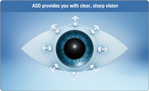 Clear, stable vision for astigmats thanks to Accelerated Stabilisation Design™ (ASD).
